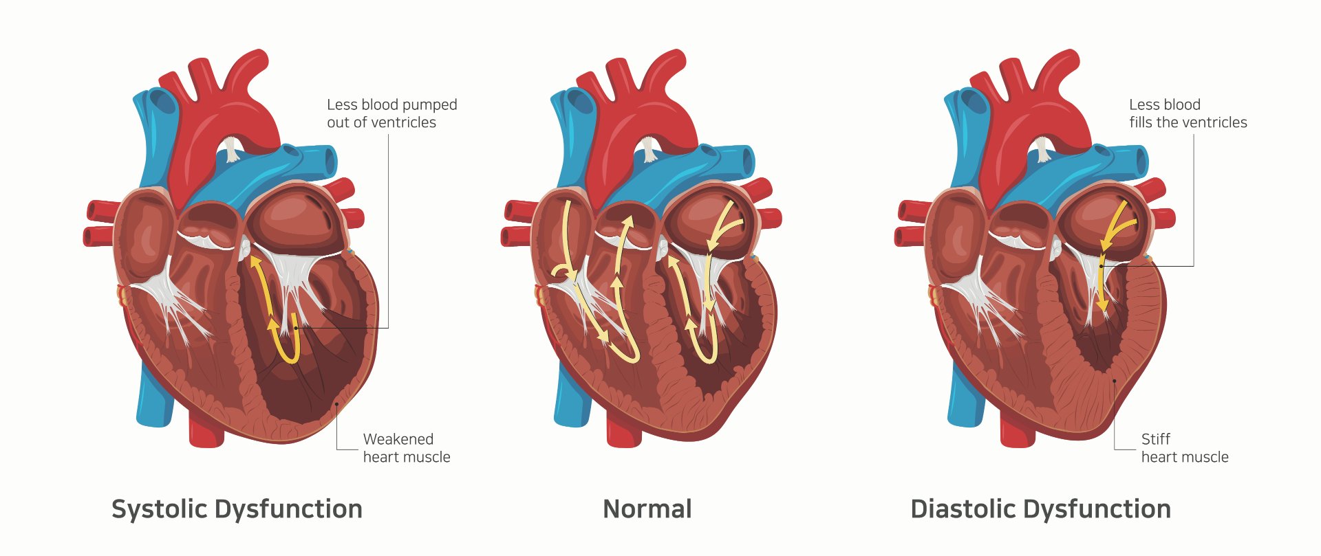 heart-failure-predictions-based-on-patients-health-attributes-thanh